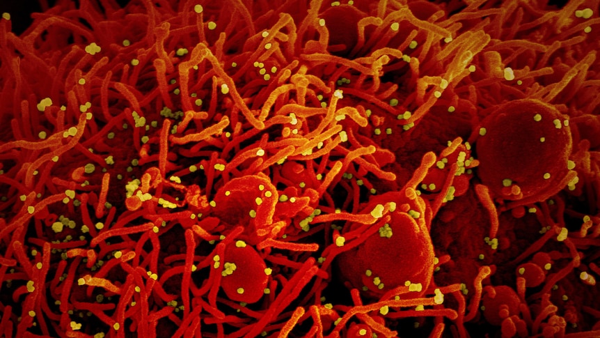 You see a bright red and yellow electron micrograph of cell strands infected by yellow dot-like particles.
