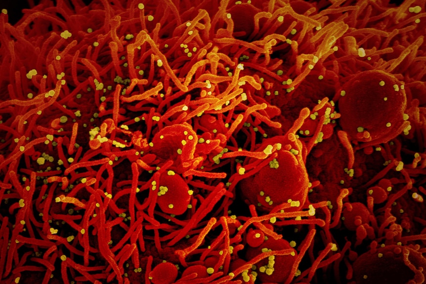 You see a bright red and yellow electron micrograph of cell strands infected by yellow dot-like particles.