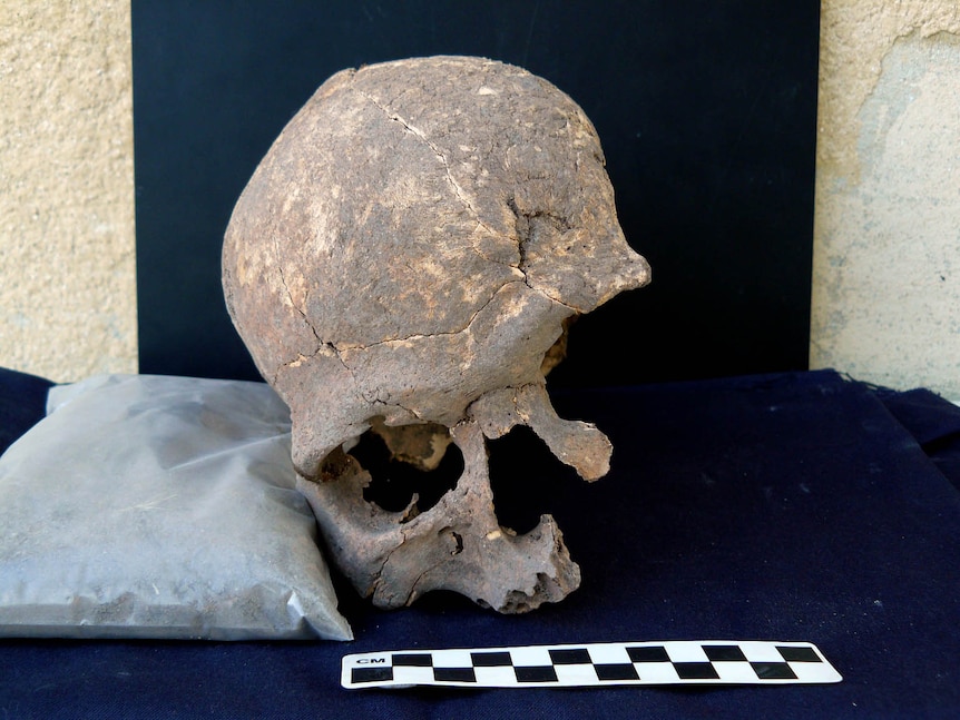 Neolithic skull recovered from grave