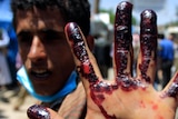 A protester displays a blood-stained hand after carrying a wounded protester after clashes with security forces