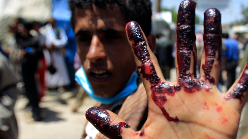 A protester displays a blood-stained hand after carrying a wounded protester after clashes with security forces