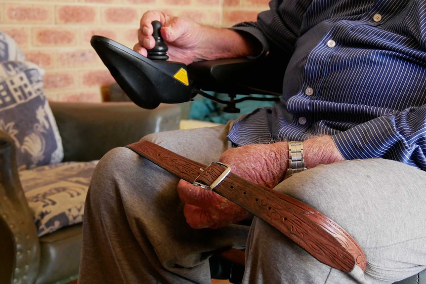 Close up of the leather belt strapped around George's legs, preventing his legs from falling out of place.