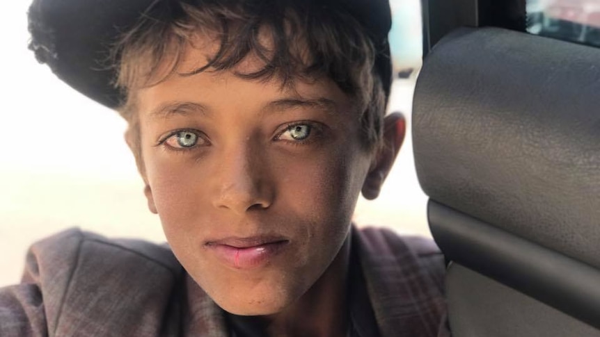 A Yemeni boy, Mohammad, with the striking blue eyes.