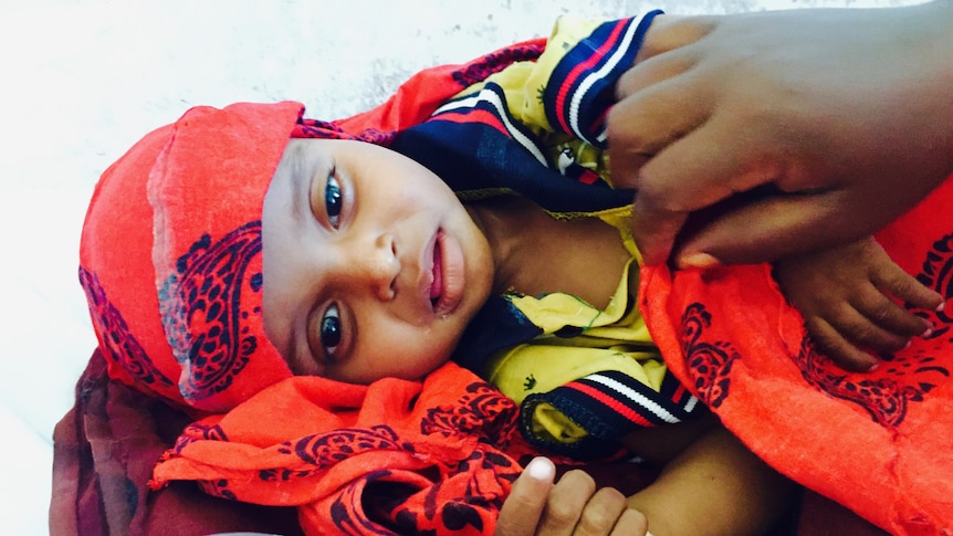 Child suffering with acute watery diarrhoea in Somaliland