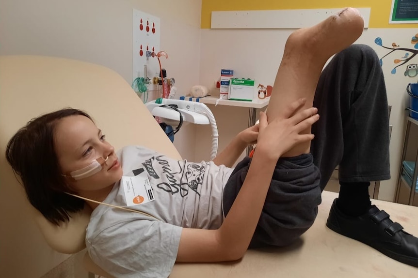 boy sitting on bed holding up his leg which is half cut off