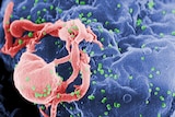 HIV-1, coloured green, budding from a cultured lymphocyte.