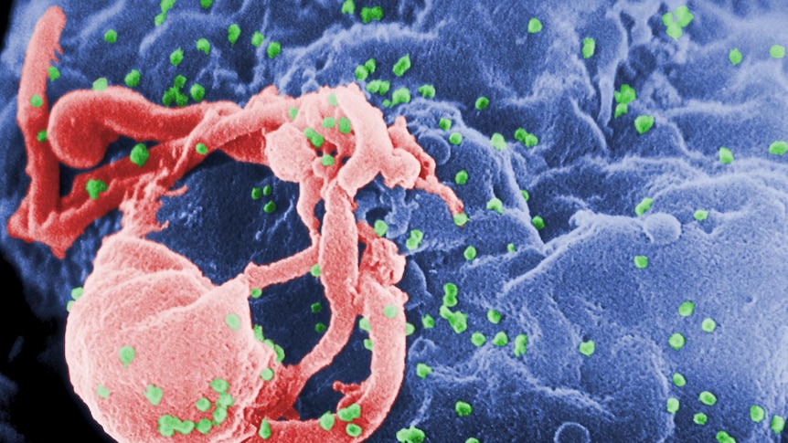 HIV-1 buds from a cultured lymphocyte