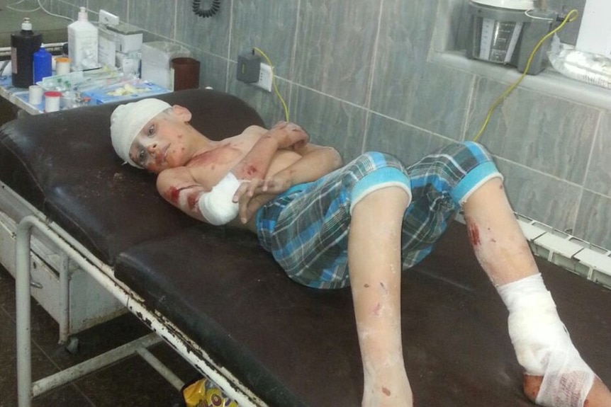 A young boy's injuries are treated in Aleppo.