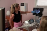 A woman points to an ultrasound screen