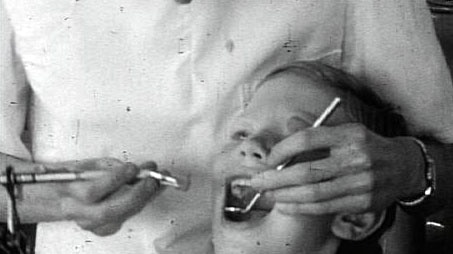 Old photo of child receiving dental treatment