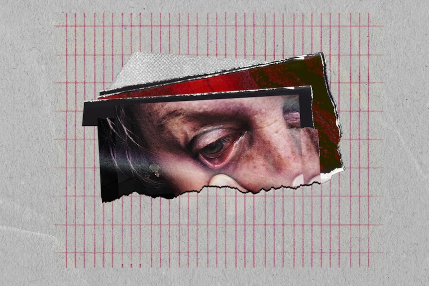 On grey paper with red grid a ripped photo shows close-up of woman inspecting inside of the bottom of her eye.