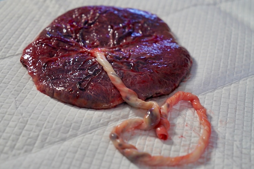 A placenta