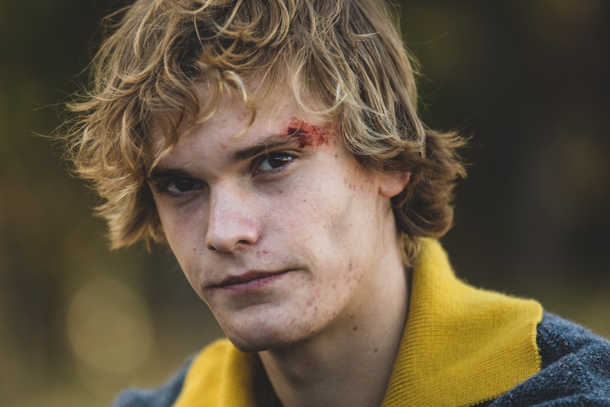 Close up of young man with shaggy blond hair and a bleeding brow after playing football