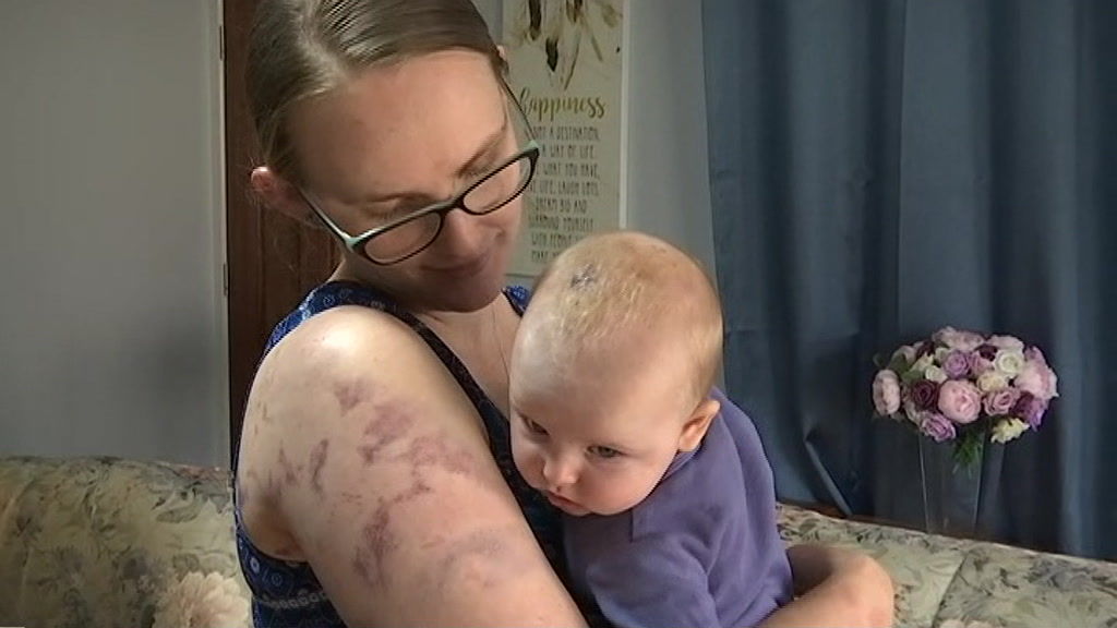 Mother who shielded baby from hail stones during supercell storm in line for bravery award - ABC News