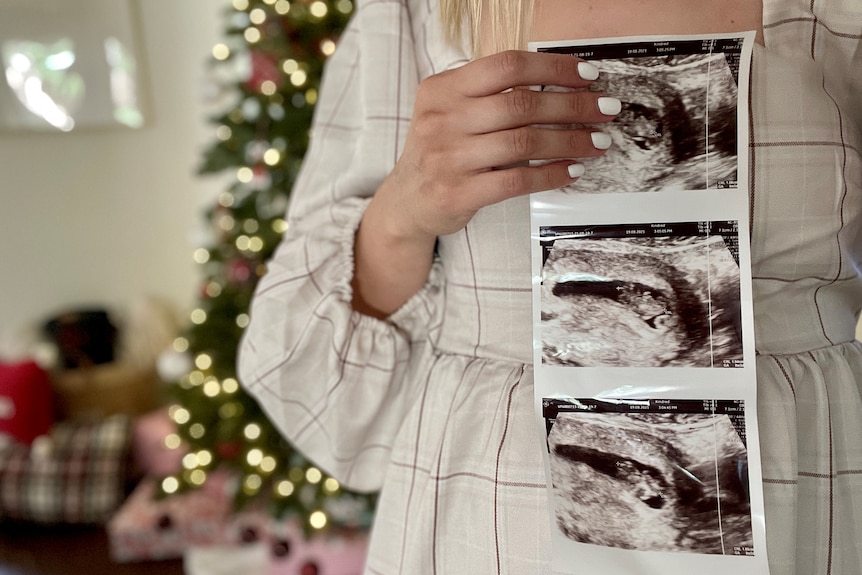A woman holds a sonogram across her stomach in front of a Christmas tree.