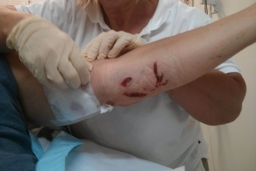 A man with a bloody arm being bandaged in hospital 