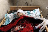 An badly injured man lies in a bed at a makeshift clinic in the city of Idlib