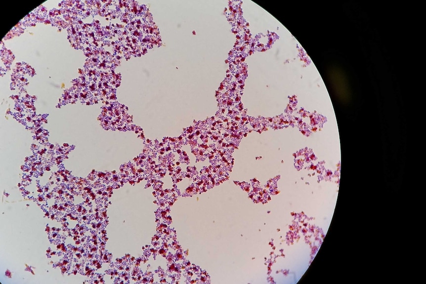 Petri dish showing bacterial colonies of Staphylococcus aureus