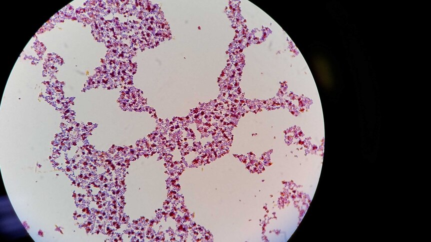 Petri dish showing bacterial colonies of Staphylococcus aureus