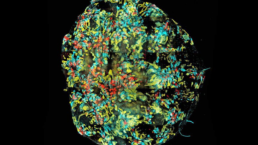 A colourful image of a mini kidney created in a dish by scientists from reprogrammed adult stem cells