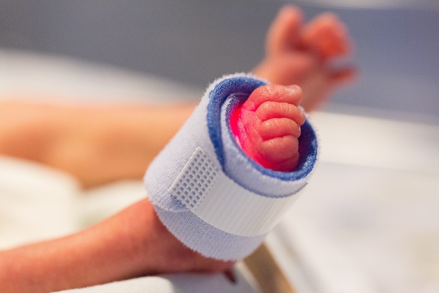 the feet of a premature baby in icu