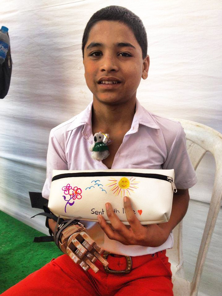 A schoolboy in Bangalore holds a pencil case while wearing a prosthetic hand.