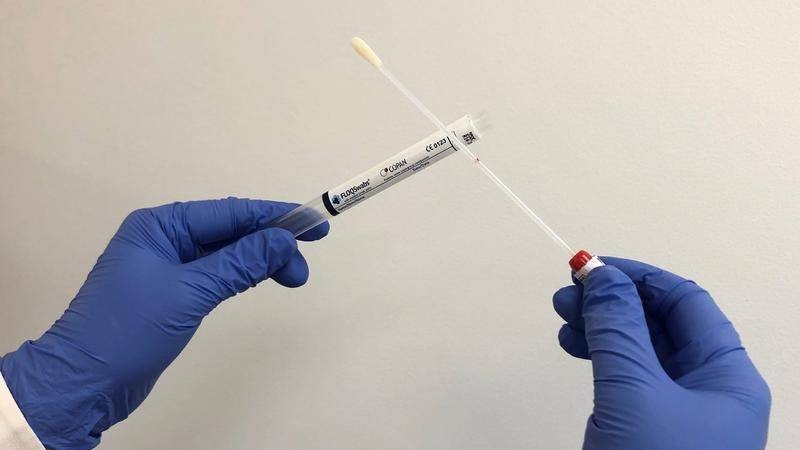 A person with blue gloves holds up a cervical cancer screening cotton swab and test tube