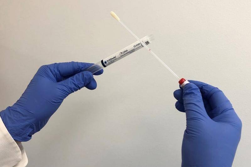 A person with blue gloves holds up a cervical cancer screening cotton swab and test tube