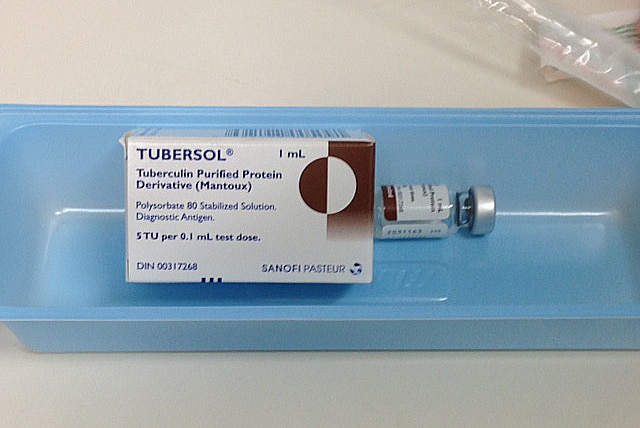 NT health authorities want people who might be at risk of tuberculosis to get a mantoux test.