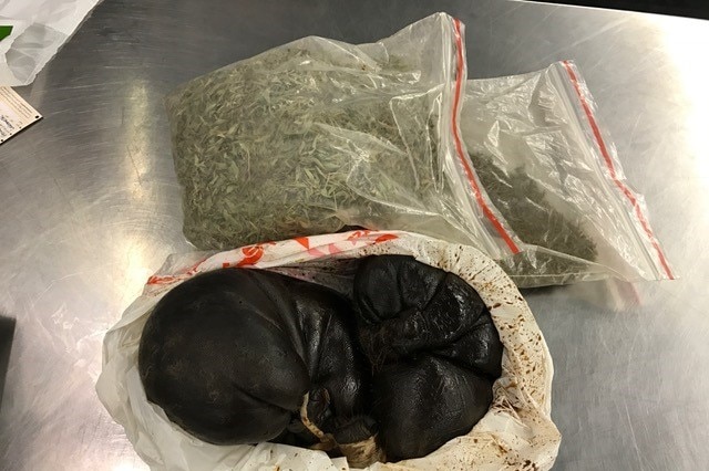 The biosecurity team at Sydney Airport confiscated a goat foetus.