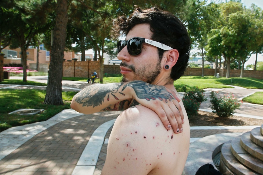 A man with sunglasses on stands shirtless, and shows off bullet fragment marks on his upper left back.