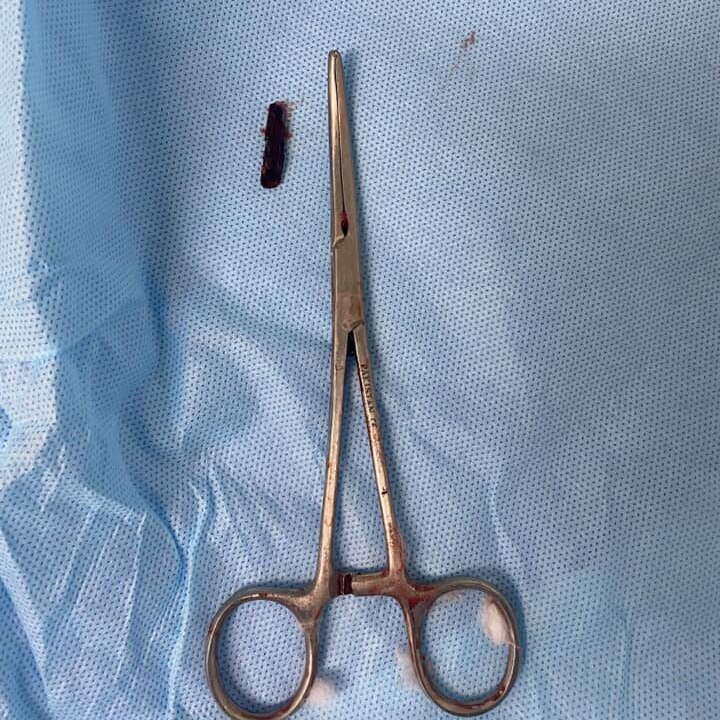 A small piece of wood next to medical scissors, for scale.