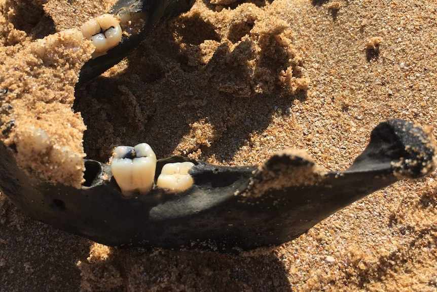 A close up photo of a black human jaw bone with two teeth inside.