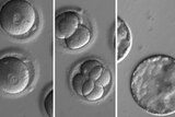 A series of images showing microscopic level cells changing.