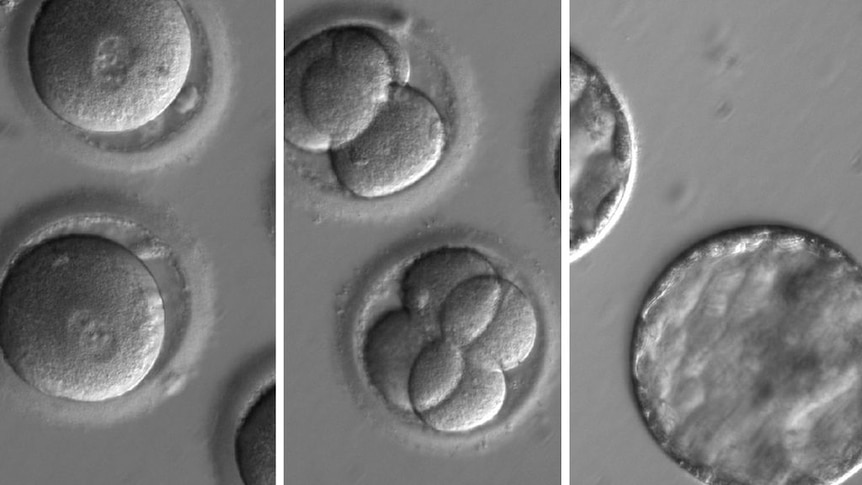 A series of images showing microscopic level cells changing.