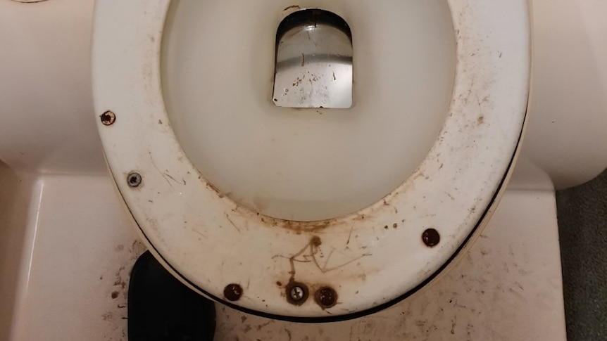 A toilet with rusted bolts on the seat, grime and dirt.