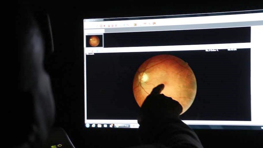 A doctor looks at a scan of an eye of a computer to try and detect disease.