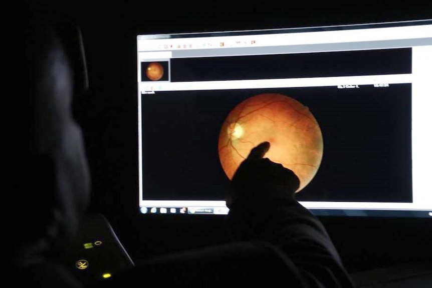 A doctor looks at a scan of an eye of a computer to try and detect disease.