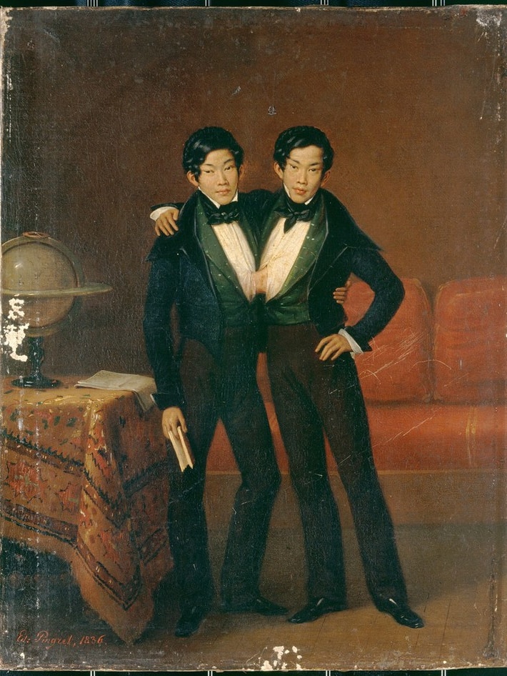 oil painting of two young men of asian appearance conjoined by a band of skin at the chest 