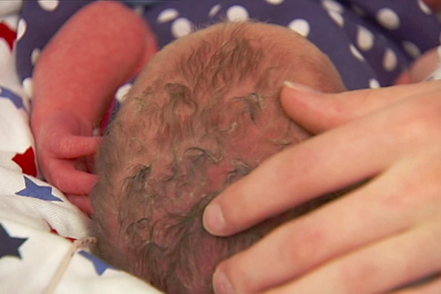 The top of a baby's head being held in hands