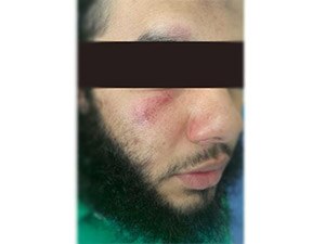 Alleged police brutality victim
