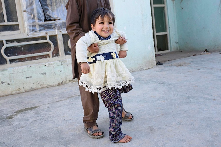 Shaesta, a smiling toddler with one leg, plays with her brother.