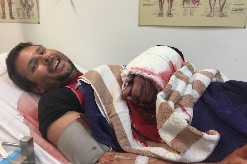 Mathew Vickers with his arm strapped up after being bitten by a shark