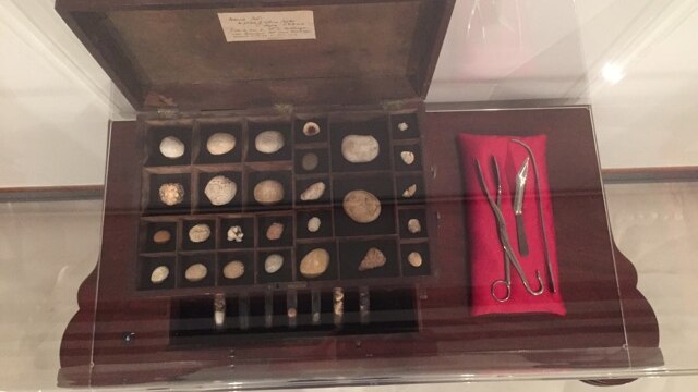 Part of the collection is a medicine chest with bladder stones and lithotomy tools