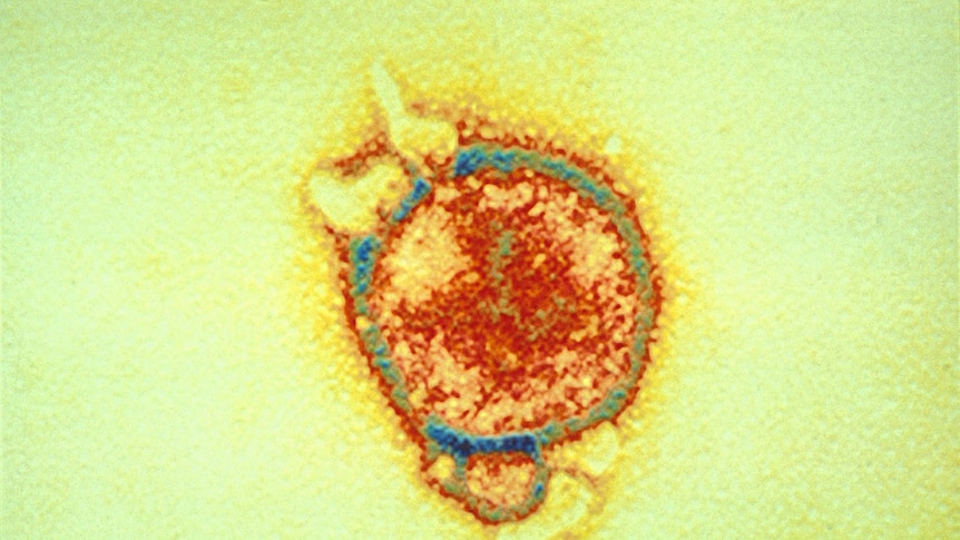 Electron micrograph of hendra virus