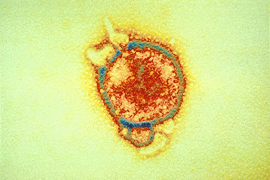 This artificially coloured electron micrograph of hendra virus is from the first identified case in Brisbane in 1994.