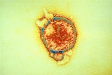 This artificially coloured electron micrograph of hendra virus is from the first identified case in Brisbane in 1994.