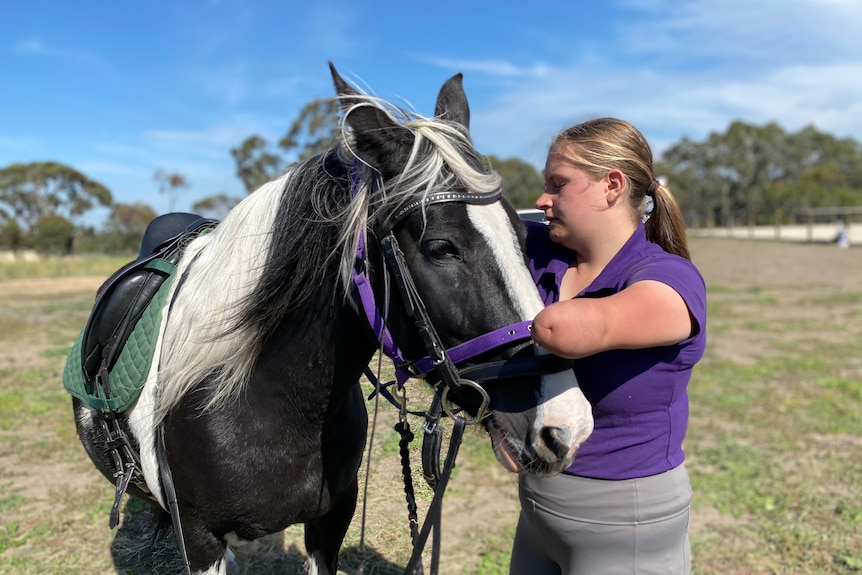 Abby Vidler, who has no forearms, standing with a black and white horse.