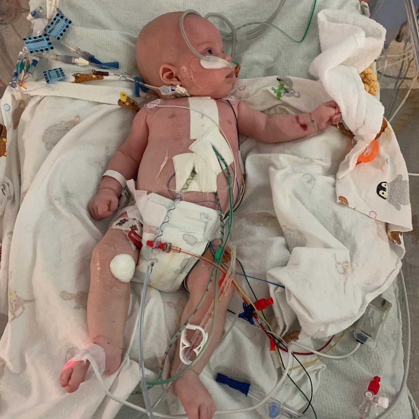 A baby in a hospital ward hooked up with wires and tubes.