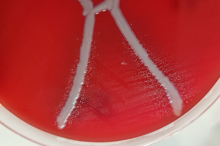 Red gel in a petri dish with white fuzzy bacteria growing on it.